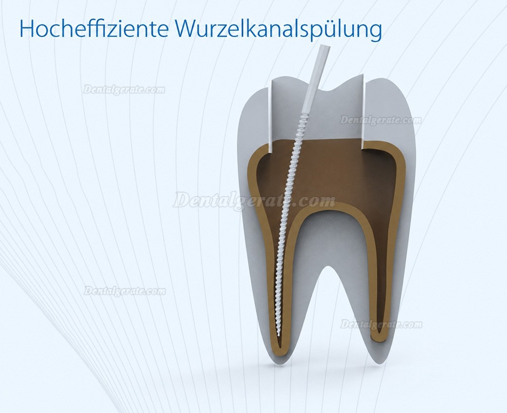 Refine DS7+ UltraschallScaler Wurzelkanalbew&auml;sserung Scaler Kompatibles EMS / Woodpecker